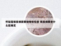 怀疑是银屑病需要做哪些检查 银屑病要查什么能确定