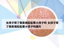女孩子得了银屑病后能要小孩子吗 女孩子得了银屑病后能要小孩子吗图片