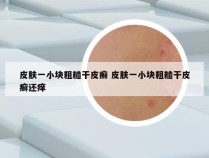 皮肤一小块粗糙干皮癣 皮肤一小块粗糙干皮癣还痒