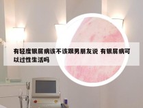 有轻度银屑病该不该跟男朋友说 有银屑病可以过性生活吗