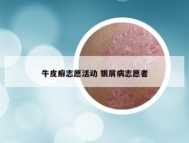 牛皮癣志愿活动 银屑病志愿者
