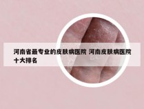 河南省最专业的皮肤病医院 河南皮肤病医院十大排名