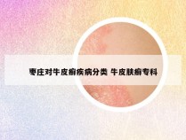 枣庄对牛皮癣疾病分类 牛皮肤癣专科
