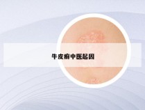 牛皮癣中医起因