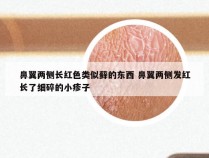 鼻翼两侧长红色类似藓的东西 鼻翼两侧发红长了细碎的小疹子
