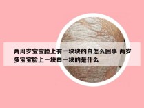 两周岁宝宝脸上有一块块的白怎么回事 两岁多宝宝脸上一块白一块的是什么