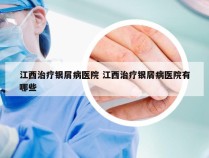 江西治疗银屑病医院 江西治疗银屑病医院有哪些