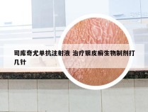 司库奇尤单抗注射液 治疗银皮癣生物制剂打几针