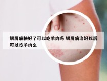 银屑病快好了可以吃羊肉吗 银屑病治好以后可以吃羊肉么