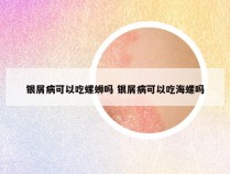 银屑病可以吃螺蛳吗 银屑病可以吃海螺吗
