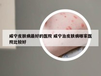 咸宁皮肤病最好的医院 咸宁治皮肤病哪家医院比较好