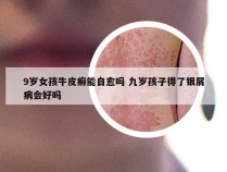 9岁女孩牛皮癣能自愈吗 九岁孩子得了银屑病会好吗