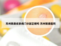 苏州银康皮肤病门诊部正规吗 苏州银康医院