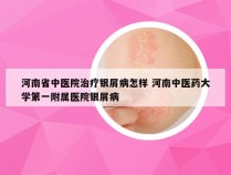 河南省中医院治疗银屑病怎样 河南中医药大学第一附属医院银屑病