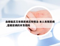 血糖偏高又有银屑病怎样根治 本人有银屑病 ,是糖尿病的并发症吗