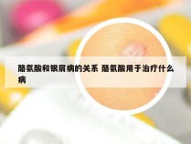 酪氨酸和银屑病的关系 酪氨酸用于治疗什么病