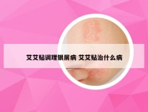 艾艾贴调理银屑病 艾艾贴治什么病