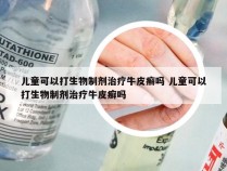 儿童可以打生物制剂治疗牛皮癣吗 儿童可以打生物制剂治疗牛皮癣吗