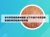 非寻常型银屑病有哪些 以下不属于寻常型银屑病的典型临床特征的是