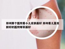 郑州那个医院看小儿皮肤最好 郑州看儿童皮肤好的医院哪家最好
