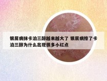 银屑病抹卡泊三醇越来越大了 银屑病擦了卡泊三醇为什么出现很多小红点
