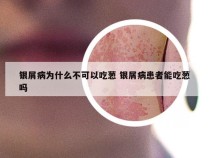 银屑病为什么不可以吃葱 银屑病患者能吃葱吗