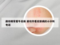 廊坊哪家看牛皮癣 廊坊市看皮肤病的小诊所电话