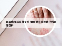 银屑病可以吃菌子吗 银屑病可以吃菌子吗百度百科