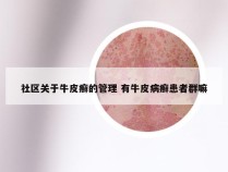 社区关于牛皮癣的管理 有牛皮病癣患者群嘛
