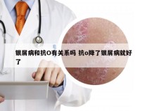 银屑病和抗O有关系吗 抗o降了银屑病就好了