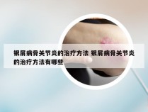 银屑病骨关节炎的治疗方法 银屑病骨关节炎的治疗方法有哪些