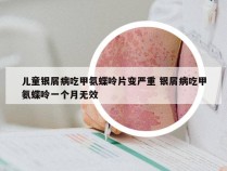 儿童银屑病吃甲氨蝶呤片变严重 银屑病吃甲氨蝶呤一个月无效
