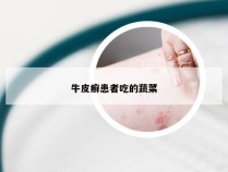 牛皮癣患者吃的蔬菜