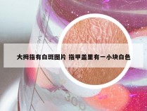 大拇指有白斑图片 指甲盖里有一小块白色
