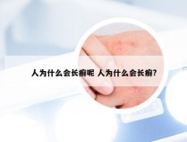 人为什么会长癣呢 人为什么会长癣?