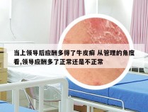 当上领导后应酬多得了牛皮癣 从管理的角度看,领导应酬多了正常还是不正常