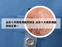 山东十大银屑病医院排名 山东十大银屑病医院排名第一