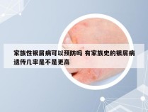 家族性银屑病可以预防吗 有家族史的银屑病遗传几率是不是更高