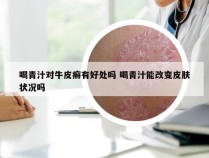 喝青汁对牛皮癣有好处吗 喝青汁能改变皮肤状况吗