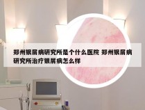郑州银屑病研究所是个什么医院 郑州银屑病研究所治疗银屑病怎么样