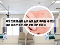 寻常型银屑病黑色素由黑色变成褐色 寻常型银屑病黑色素由黑色变成褐色的原因