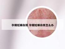 孕期妊娠白斑 孕期妊娠白斑怎么办