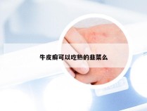 牛皮癣可以吃熟的韭菜么