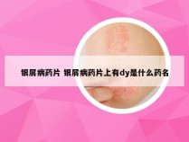 银屑病药片 银屑病药片上有dy是什么药名