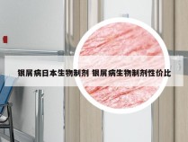 银屑病日本生物制剂 银屑病生物制剂性价比
