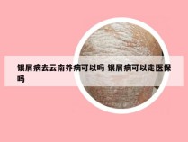 银屑病去云南养病可以吗 银屑病可以走医保吗