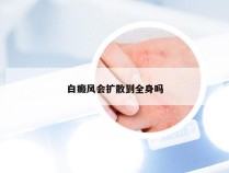 白癜风会扩散到全身吗