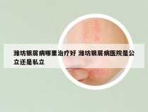 潍坊银屑病哪里治疗好 潍坊银屑病医院是公立还是私立