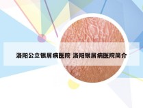 洛阳公立银屑病医院 洛阳银屑病医院简介