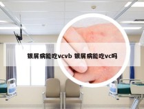 银屑病能吃vcvb 银屑病能吃vc吗